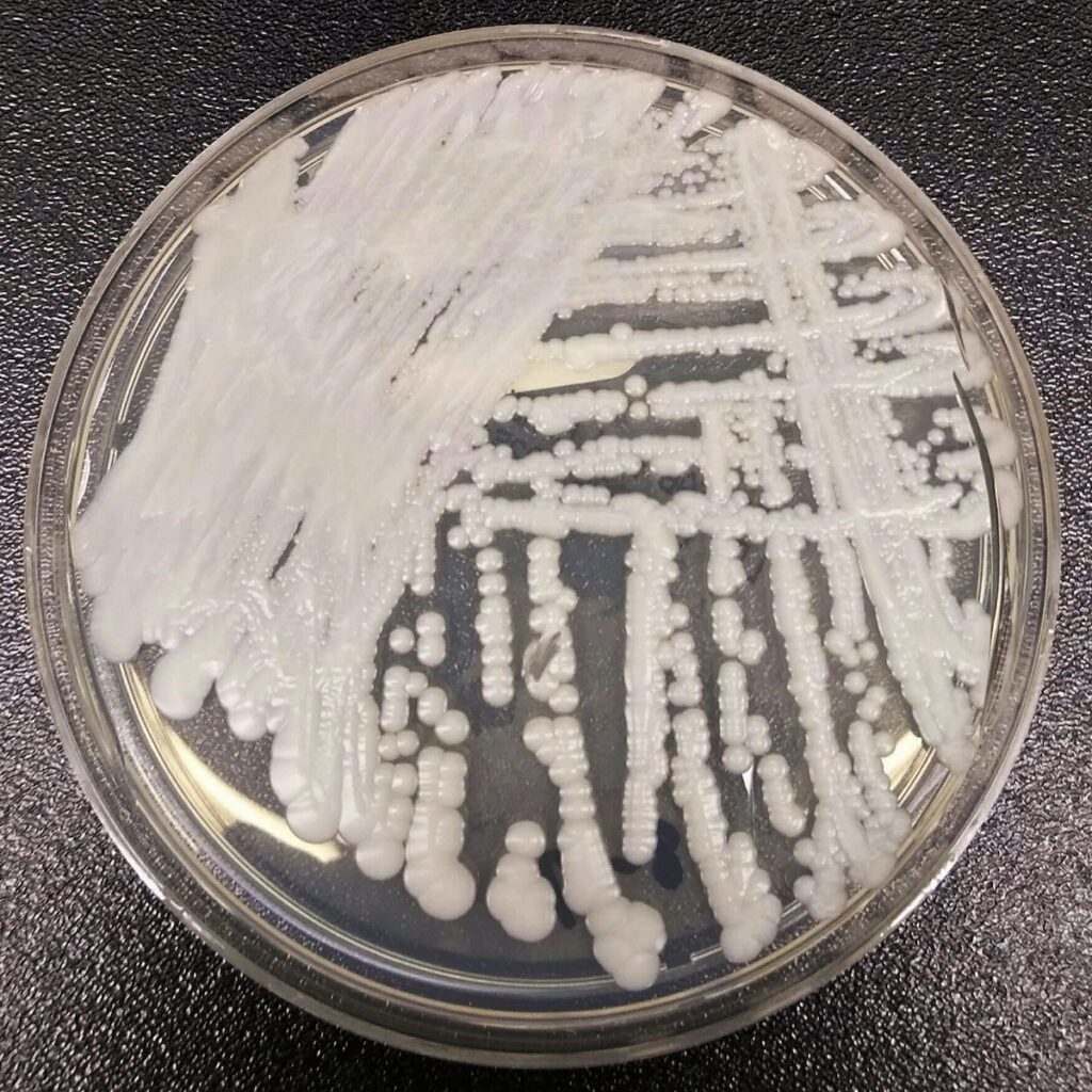 Candidozyma auris odlad i en petriskål på ett laboratorium. 